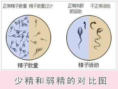 畸形精子是什么原因