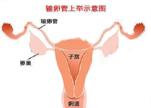 <b>什么是输卵管上举？输卵管上举影响怀孕吗？</b>