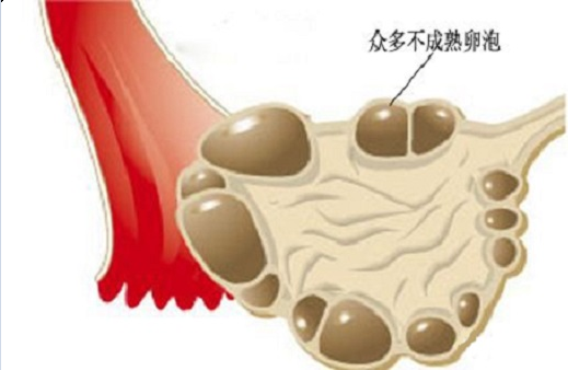 <b>卵泡不成熟还能做试管婴儿吗？</b>