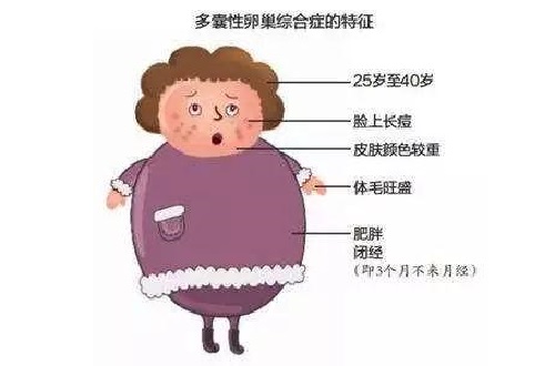 <b>胖多囊和瘦多囊都有什么区别？</b>