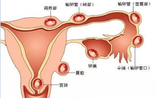 <b>很危险的怀孕情况都有哪些？</b>