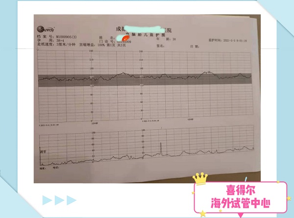 <b>恭喜爱心志愿者38周胎心监护一次通过！</b>