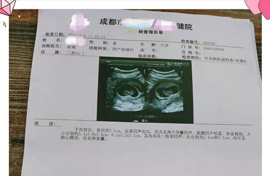 <b>恭喜高龄双胞胎妈妈顺利建卡！</b>