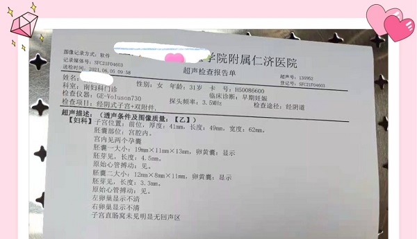 <b>又一对双胞胎完美上线</b>