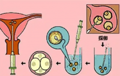 <b>试管取卵和试管移植前后注意事项</b>