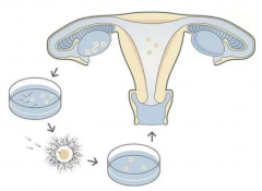 <b>试管取卵后怎么保养卵巢 试管取卵流程</b>