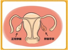 <b>卵巢早衰还能恢复吗 卵巢早衰想怀孕可以吗？</b>