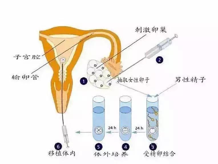 试管婴儿的步骤及费用 最新试管婴儿的费用和流程