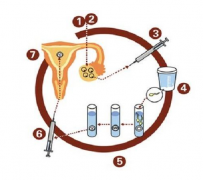 <b>试管取卵过程 试管取卵过程疼不疼</b>