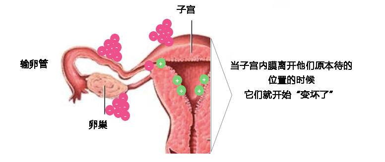 卵巢“巧克力囊肿”合并不孕，手术吗？