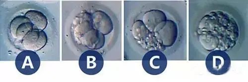 试管婴儿反复移植失败是什么因素造成的？