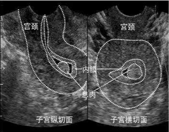 什么样的子宫内膜容易好孕？如何拥有?