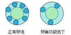 试管备孕| 你了解窦卵泡计数(AFC)吗?