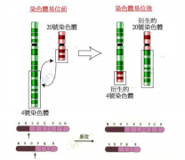 <b>染色体平衡易位造成胎停流产怎么办？</b>